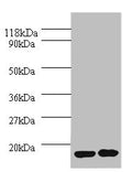 Western blot
All lanes: IL1RN antibody at 2µg/ml
Lane 1: EC109 whole cell lysate
Lane 2: 293T whole cell lysate
Secondary
Goat polyclonal to rabbit IgG at 1/10000 dilution
Predicted band size: 21, 18, 20, 17 kDa
Observed band size: 17 kDa