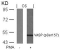 Western blot analysis of extracts from C6 cells untreated or treated with PMA using VASP(Phospho-Ser157) Antibody.