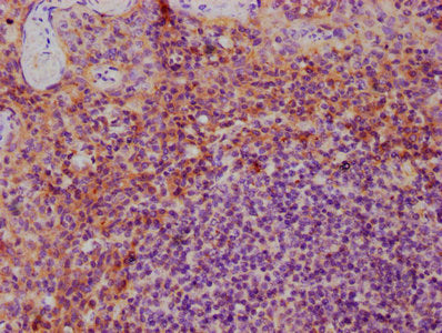 IHC image of CSB-PA06725A0Rb diluted at 1:600 and staining in paraffin-embedded human tonsil tissue performed on a Leica BondTM system. After dewaxing and hydration, antigen retrieval was mediated by high pressure in a citrate buffer (pH 6.0). Section was blocked with 10% normal goat serum 30min at RT. Then primary antibody (1% BSA) was incubated at 4°C overnight. The primary is detected by a biotinylated secondary antibody and visualized using an HRP conjugated SP system.