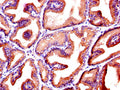 IHC image of CSB-PA06779A0Rb diluted at 1:600 and staining in paraffin-embedded human prostate tissue performed on a Leica BondTM system. After dewaxing and hydration, antigen retrieval was mediated by high pressure in a citrate buffer (pH 6.0). Section was blocked with 10% normal goat serum 30min at RT. Then primary antibody (1% BSA) was incubated at 4&deg;C overnight. The primary is detected by a biotinylated secondary antibody and visualized using an HRP conjugated SP system.