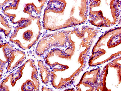 IHC image of CSB-PA06779A0Rb diluted at 1:600 and staining in paraffin-embedded human prostate tissue performed on a Leica BondTM system. After dewaxing and hydration, antigen retrieval was mediated by high pressure in a citrate buffer (pH 6.0). Section was blocked with 10% normal goat serum 30min at RT. Then primary antibody (1% BSA) was incubated at 4&deg;C overnight. The primary is detected by a biotinylated secondary antibody and visualized using an HRP conjugated SP system.