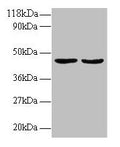Western blot
All lanes: TNFSF14 antibody at 2µg/ml
Lane 1: EC109 whole cell lysate
Lane 2: 293T whole cell lysate
Secondary
Goat polyclonal to rabbit IgG at 1/15000 dilution
Predicted band size: 27, 23 kDa
Observed band size: 45 kDa