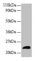 Western blot
All lanes: LCN2 antibody at 2µg/ml + Human positive serum
Secondary
Goat polyclonal to rabbit IgG at 1/15000 dilution
Predicted band size: 23 kDa
Observed band size: 23 kDa