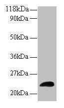 Western blot
All lanes: LCN2 antibody at 2µg/ml + Human positive serum
Secondary
Goat polyclonal to rabbit IgG at 1/15000 dilution
Predicted band size: 23 kDa
Observed band size: 23 kDa