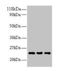 Western blot
All lanes: LCN2 antibody at 2µg/ml
Lane 1: Human positive serum at 1: 10
Lane 2: Human positive serum at 1: 100
Lane 3: Human positive serum at 1: 500
Secondary
Goat polyclonal to rabbit IgG at 1/15000 dilution
Predicted band size: 23 kDa
Observed band size: 23 kDa