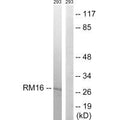 Western blot analysis of extracts from 293 cells, using MRPL16 antibody.