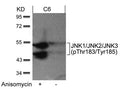 Western blot analysis of extracts from C6 cells untreated or treated with anisomycin using JNK1/JNK2/JNK3(phospho-Thr183/Tyr185) Antibody.