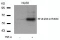 Western blot analysis of extracts from HL60 cells untreated or treated with TNF-a using NFkB-p65(Phospho-Thr505) Antibody.