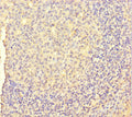 Immunohistochemistry of paraffin-embedded human tonsil tissue using CSB-PA06859A0Rb at dilution of 1:100