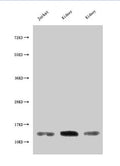 Western Blot
Positive WB detected in: Jurkat whole cell lysate, Rat kidney tissue, Mouse kidney tissue
All lanes: MIF antibody at 3µg/ml
Secondary
Goat polyclonal to rabbit IgG at 1/50000 dilution
Predicted band size: 13 kDa
Observed band size: 13 kDa