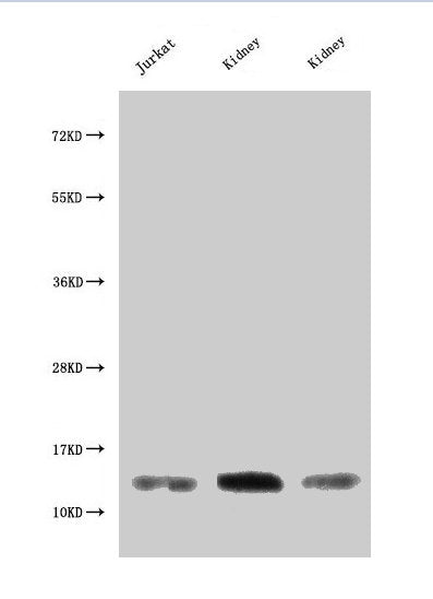 Western Blot
Positive WB detected in: Jurkat whole cell lysate, Rat kidney tissue, Mouse kidney tissue
All lanes: MIF antibody at 3µg/ml
Secondary
Goat polyclonal to rabbit IgG at 1/50000 dilution
Predicted band size: 13 kDa
Observed band size: 13 kDa