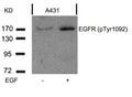 Western blot analysis of extracts from A431 cells untreated or treated with EGF using EGFR(Phospho-Tyr1092) Antibody.