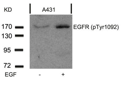 Western blot analysis of extracts from A431 cells untreated or treated with EGF using EGFR(Phospho-Tyr1092) Antibody.