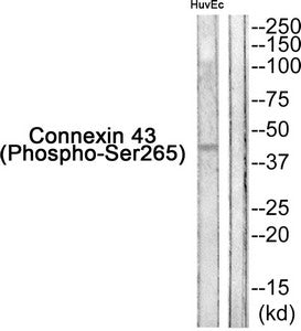 Western blot analysis of extracts from HuvEc cells using Connexin 43 (Phospho-Ser265) Antibody.The lane on the right is treated with the antigen-specific peptide.