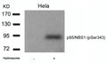 Western blot analysis of extracts from Hela cells untreated or treated with Hydroxyurea using p95/NBS1(Phospho-Ser343) Antibody.