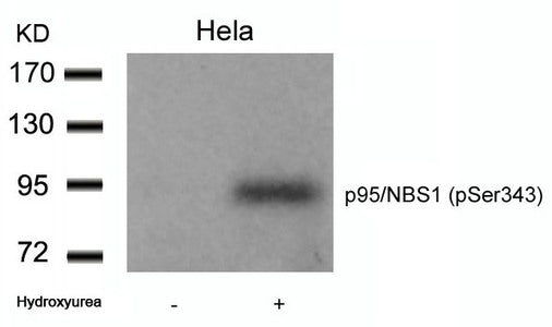 Western blot analysis of extracts from Hela cells untreated or treated with Hydroxyurea using p95/NBS1(Phospho-Ser343) Antibody.