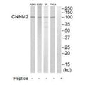 Western blot analysis of extracts from Hela cells, K562 cells, Jurkat cells and A549 cells, using CNNM2 antibody.