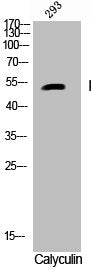 Western Blot analysis of 293 cells using Phospho-Caspase-9 (S196) Polyclonal Antibody