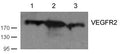 Western blot analysis of cell lysates using VEGFR2(Ab-1059) antibody Lane 1 and 2: Huvec cell;  Lane 3 HT29 cell)