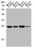 Phospho-FADD (S194) Antibody – Figure 1 of 1