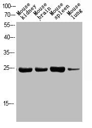 Phospho-FADD (S194) Antibody – Figure 1 of 1