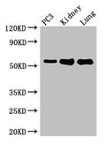 Western Blot
Positive WB detected in: PC-3 whole cell lysate, Mouse kidney tissue, Mouse lung tissue
All lanes: MMP13 antibody at 2µg/ml
Secondary
Goat polyclonal to rabbit IgG at 1/50000 dilution
Predicted band size: 54 kDa
Observed band size: 54 kDa