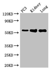 Western Blot
Positive WB detected in: PC-3 whole cell lysate, Mouse kidney tissue, Mouse lung tissue
All lanes: MMP13 antibody at 2µg/ml
Secondary
Goat polyclonal to rabbit IgG at 1/50000 dilution
Predicted band size: 54 kDa
Observed band size: 54 kDa