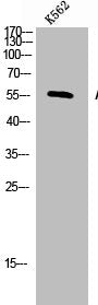 Western Blot analysis of K562 cells using ALK-1 Polyclonal Antibody
