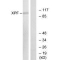 Western blot analysis of extracts from 293 cells, using XPF antibody.