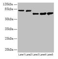 Western blot
All lanes: APP antibody at 2.4µg/ml
Lane 1: Mouse brain tissue
Lane 2: 293 whole cell lysate
Lane 3: A549 whole cell lysate
Lane 4: U251 whole cell lysate
Lane 5: SH-SY5Y whole cell lysate
Secondary
Goat polyclonal to rabbit IgG at 1/15000 dilution
Predicted band size: 87, 35, 77, 79, 81, 83, 85, 86, 73 kDa
Observed band size: 81, 73 kDa