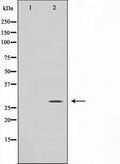 Western blot analysis on Jurkat cell lysate using GADD153 Antibody