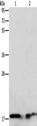 Gel: 12%SDS-PAGE, Lysate: 40 ug, Lane 1-2: Human normal liver tissue, Human fetal liver tissue, Primary antibody: CSB-PA071857(ANG Antibody) at dilution 1/133, Secondary antibody: Goat anti rabbit IgG at 1/8000 dilution, Exposure time: 20 seconds