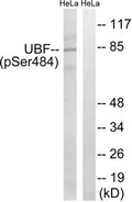 Western blot analysis of extracts from HeLa cells, treated with calyculinA (50ng/ml, 30mins), using UBF (Phospho-Ser484) antibody. The lane on the right is treated with the synthesized peptide.