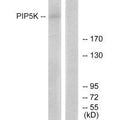 PIKFYVE Antibody – Figure 1 of 2