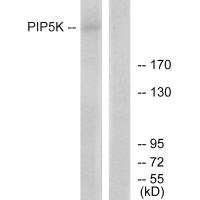 PIKFYVE Antibody – Figure 1 of 2