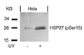 Western blot analysis of extracts from Hela cells untreated or treated with UV using HSP27(Phospho-Ser15) Antibody.