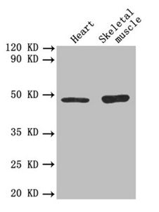 Western blot
All lanes: TGFB2 antibody at 3µg/ml
Lane 1: Mouse heart tissue
Lane 2: Mouse skeletal muscle tissue
Secondary
Goat polyclonal to rabbit IgG at 1/10000 dilution
Predicted band size: 48, 51 kDa
Observed band size: 48 kDa