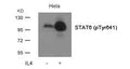 Western blot analysis of extracts from Hela cells untreated or treated with IL-4 using STAT6(Phospho-Tyr641) Antibody.