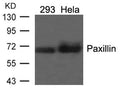 Western blot analysis of extracts from 293 and Hela cells using Paxillin(Ab-118) Antibody.