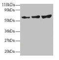 Western blot
All lanes: TIMP2 antibody at 2µg/ml
Lane 1: EC109 whole cell lysate
Lane 2: 293T whole cell lysate
Secondary
Goat polyclonal to rabbit IgG at 1/15000 dilution
Predicted band size: 25 kDa
Observed band size: 60 kDa