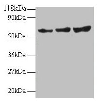 Western blot
All lanes: TIMP2 antibody at 2µg/ml
Lane 1: EC109 whole cell lysate
Lane 2: 293T whole cell lysate
Secondary
Goat polyclonal to rabbit IgG at 1/15000 dilution
Predicted band size: 25 kDa
Observed band size: 60 kDa