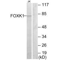 Western blot analysis of extracts from Jurkat cells, using FOXK1 antibody.