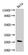 Western Blot
Positive WB detected in: Hela whole cell lysate
All lanes: TNF antibody at 3.2µg/ml
Secondary
Goat polyclonal to rabbit IgG at 1/50000 dilution
Predicted band size: 26 kDa
Observed band size: 26 kDa