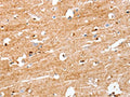 The image on the left is immunohistochemistry of paraffin-embedded Human brain tissue using CSB-PA074357(S100B Antibody) at dilution 1/50, on the right is treated with synthetic peptide. (Original magnification: ×200)