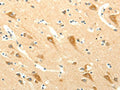 The image on the left is immunohistochemistry of paraffin-embedded Human brain tissue using CSB-PA074430(SYT5 Antibody) at dilution 1/15, on the right is treated with fusion protein. (Original magnification: ×200)
