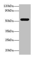 Western blot
All lanes: MMP3 antibody at 2µg/ml + Mouse liver tissue
Secondary
Goat polyclonal to rabbit lgG at 1/15000 dilution
Predicted band size: 54 kDa
Observed band size: 54 kDa