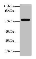 Western blot
All lanes: MMP3 antibody at 2µg/ml + Mouse liver tissue
Secondary
Goat polyclonal to rabbit lgG at 1/15000 dilution
Predicted band size: 54 kDa
Observed band size: 54 kDa