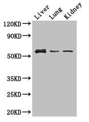 Western Blot
Positive WB detected in: Mouse liver tissue, Mouse lung tissue, Mouse kidney tissue
All lanes: MMP8 antibody at 3ug/ml
Secondary
Goat polyclonal to rabbit IgG at 1/50000 dilution
Predicted band size: 54 kDa
Observed band size: 54 kDa