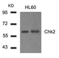Western blot analysis of extract from HL60 cells using Chk2(Ab-516) Antibody.