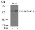 Western blot analysis of extracts from PC12 cells untreated or treated with PMA using PKCth(Phospho-Ser676) Antibody.